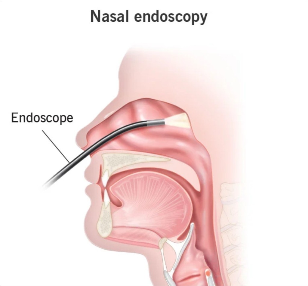 My Surprise Nasal Endoscopy, or the Case for Healthcare Price Transparency