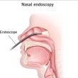 My Surprise Nasal Endoscopy, or the Case for Healthcare Price Transparency